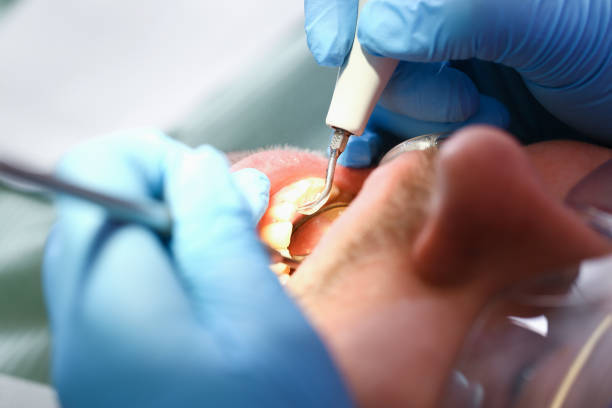 Best Emergency Root Canal Therapy in Monongah, WV
