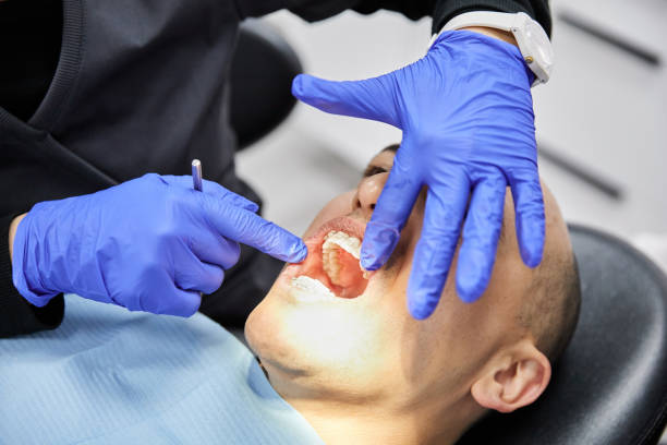 Best Broken or Chipped Tooth Repair in Monongah, WV